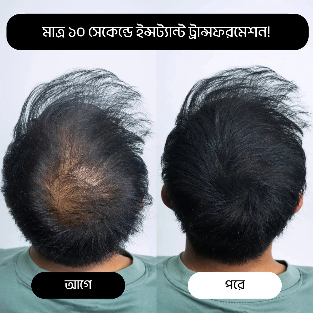 Shokhi Beauty "Cover Up" Hair Powder